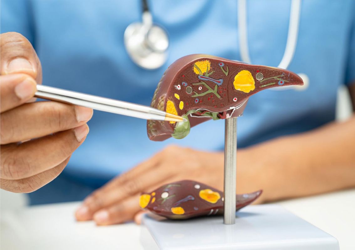 Reversing Fatty Liver Disease: Advanced Gastroenterology at Sapthagiri Hospital